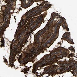 Annexin A13 Antibody, Novus Biologicals:Antibodies:Primary Antibodies