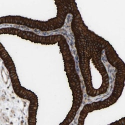 Annexin A13 Antibody, Novus Biologicals 0.1mL; Unlabeled:Antibodies, Polyclonal