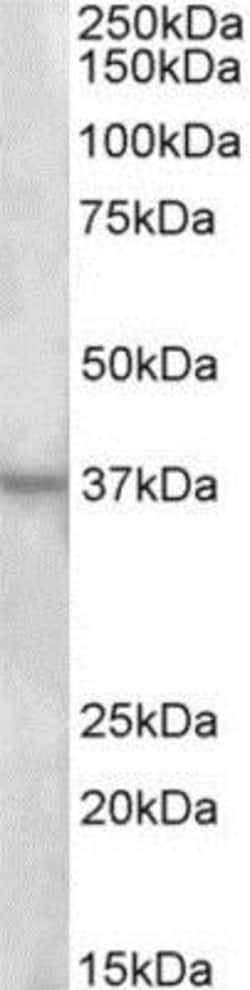 Annexin A1 Antibody, Novus Biologicals 0.1mg; Unlabeled:Antibodies, Polyclonal