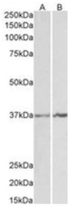 Annexin A1 Antibody, Novus Biologicals 0.1mg; Unlabeled:Antibodies, Polyclonal