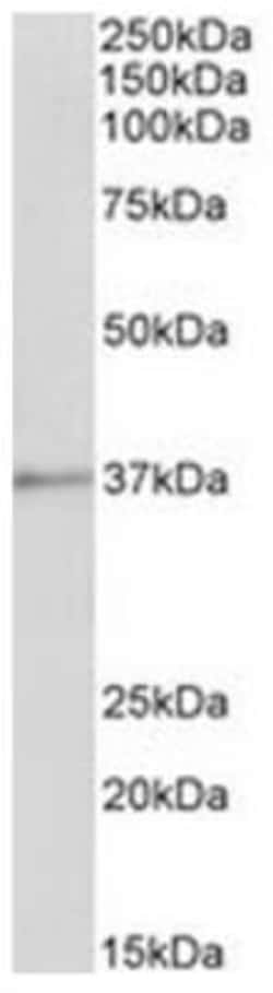Annexin A1 Antibody, Novus Biologicals 0.1mg; Unlabeled:Antibodies, Polyclonal