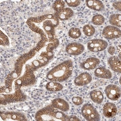 Annexin A9 Antibody, Novus Biologicals:Antibodies:Primary Antibodies