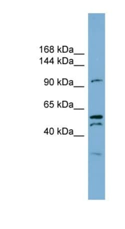 ANO6 Antibody, Novus Biologicals 0.05mg; Unlabeled:Antibodies, Polyclonal