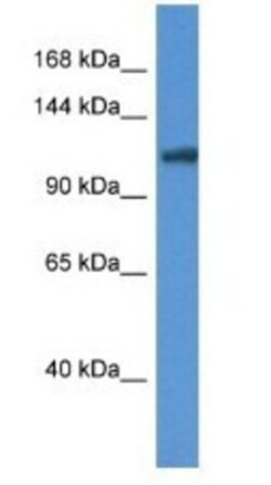 ANO6 Antibody, Novus Biologicals:Antibodies:Primary Antibodies