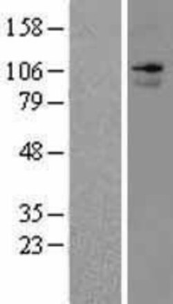 Novus Biologicals™ ANO7 Overexpression Lysate