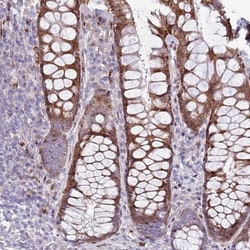 ANO8 Antibody, Novus Biologicals 25 &mu;L, Unlabeled:Antibodies, Polyclonal