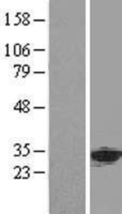 Novus Biologicals&trade;&nbsp;ANP32A Overexpression Lysate