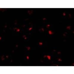 ANP32A Antibody - BSA Free, Novus Biologicals 0.1mg; Unlabeled:Antibodies,