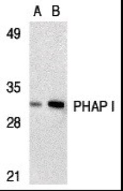 ANP32A Antibody - BSA Free, Novus Biologicals 0.1mg; Unlabeled:Antibodies,