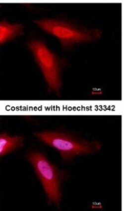 Serpin C1/Antithrombin-III Antibody, Novus Biologicals 0.1mL; Unlabeled:Antibodies,