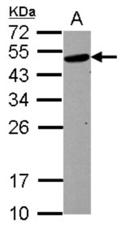 Serpin C1/Antithrombin-III Antibody, Novus Biologicals 0.1mL; Unlabeled:Antibodies,