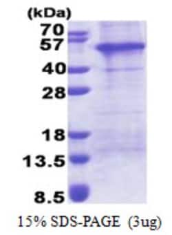 Novus Biologicals&trade;&nbsp;Recombinant Human AP1AR His Protein