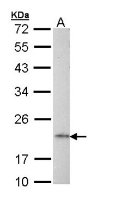 AP1S2 Antibody, Novus Biologicals 0.1mL; Unlabeled:Antibodies, Polyclonal