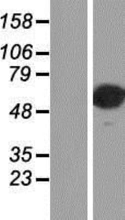 Novus Biologicals™ AP2 alpha Overexpression Lysate
