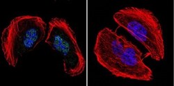AP2 alpha Antibody (3B5), Novus Biologicals 0.1mL; Unlabeled:Antibodies,