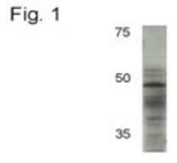 AP2 alpha Antibody (3B5), Novus Biologicals 0.1mL; Unlabeled:Antibodies,
