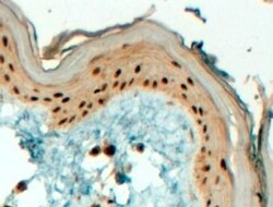 AP-2 gamma Antibody, Novus Biologicals 0.1mg; Unlabeled:Antibodies, Polyclonal