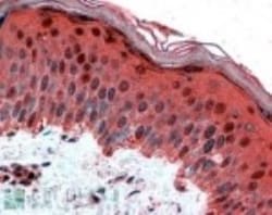 AP-2 gamma Antibody, Novus Biologicals 0.1mg; Unlabeled:Antibodies, Polyclonal