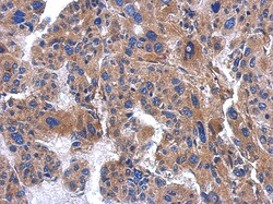 AP3M2 Antibody, Novus Biologicals 0.1mL; Unlabeled:Antibodies, Polyclonal