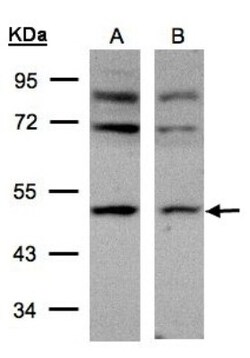 AP2M1 Antibody, Novus Biologicals 0.1mL; Unlabeled:Antibodies, Polyclonal