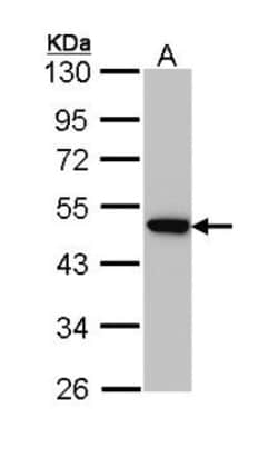 AP2M1 Antibody, Novus Biologicals 0.1mL; Unlabeled:Antibodies, Polyclonal