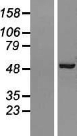 Novus Biologicals&trade;&nbsp;AP2M1 Overexpression Lysate