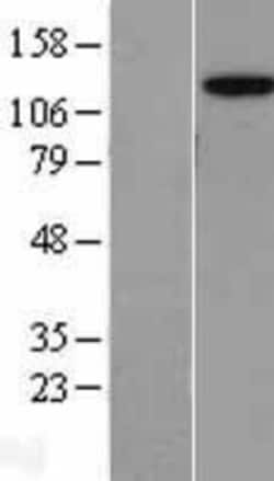 Novus Biologicals&trade;&nbsp;AP3B2 Overexpression Lysate