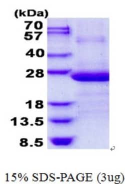 Novus Biologicals Recombinant Human AP3S1 His Protein 0.1 mg | Buy Online | Novus Biologicals&trade; | Fisher Scientific