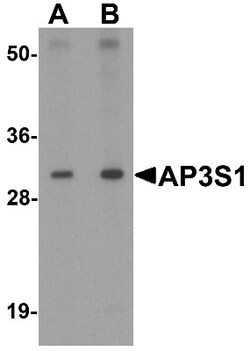 AP3S1 Antibody - BSA Free, Novus Biologicals 0.025 mg, Unconjugated:Antibodies,
