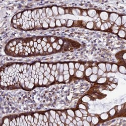 AP4S1 Antibody, Novus Biologicals 25 &mu;L; Unlabeled:Antibodies, Polyclonal