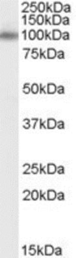 APBA1 Antibody, Novus Biologicals 0.1mg; Unlabeled:Antibodies, Polyclonal