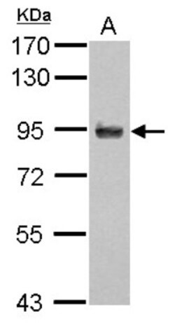 APBB2 Antibody, Novus Biologicals 0.1mL; Unlabeled:Antibodies, Polyclonal