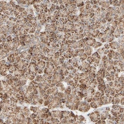 APBB2 Antibody, Novus Biologicals 25 &mu;L; Unlabeled:Antibodies, Polyclonal