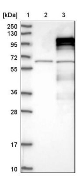 APBB2 Antibody, Novus Biologicals 25 &mu;L; Unlabeled:Antibodies, Polyclonal