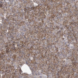 Apc1 Antibody, Novus Biologicals:Antibodies:Primary Antibodies