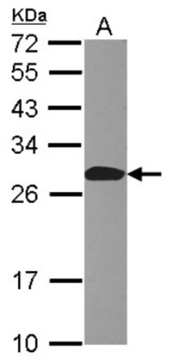 Apc10 Antibody, Novus Biologicals 0.1mL; Unlabeled:Antibodies, Polyclonal
