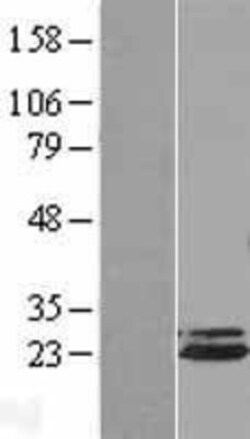 Novus Biologicals&trade;&nbsp;Apc10 Overexpression Lysate