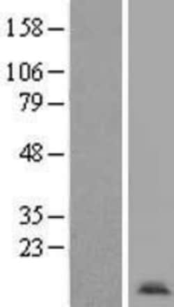 Novus Biologicals™ Apc11 Overexpression Lysate