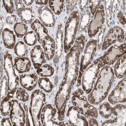Apc11 Antibody, Novus Biologicals 0.1mL; Unlabeled:Antibodies, Polyclonal