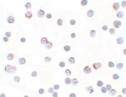 Apc2 Antibody - BSA Free, Novus Biologicals 0.1 mg | Buy Online | Novus Biologicals | Fisher Scientific