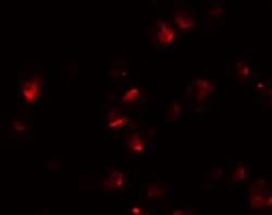 Apc2 Antibody - BSA Free, Novus Biologicals 0.1 mg | Buy Online | Novus Biologicals | Fisher Scientific