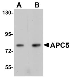 Apc5 Antibody - BSA Free, Novus Biologicals 0.1mg; Unlabeled:Antibodies,