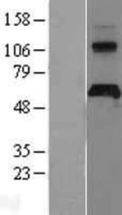 Novus Biologicals&trade;&nbsp;APCDD1 Overexpression Lysate