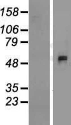 Novus Biologicals&trade;&nbsp;APCDD1L Overexpression Lysate