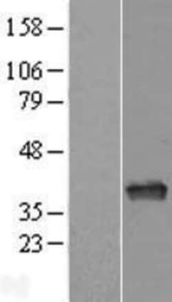 Novus Biologicals&trade;&nbsp;APE Overexpression Lysate