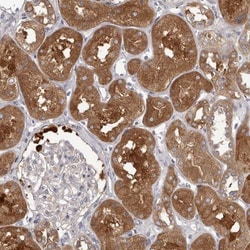 APEH Antibody, Novus Biologicals:Antibodies:Primary Antibodies