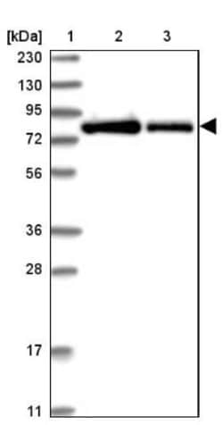 APEH Antibody, Novus Biologicals:Antibodies:Primary Antibodies