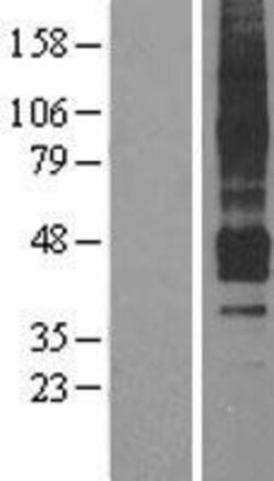 Novus Biologicals&trade;&nbsp;APJ/Apelin receptor Overexpression Lysate