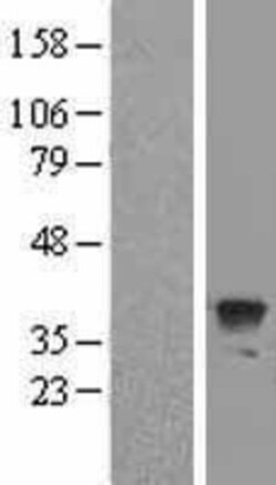 Novus Biologicals™ ATG3/APG3 Overexpression Lysate