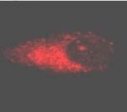 APH1A Antibody, Novus Biologicals 0.1mg; Unlabeled:Antibodies, Polyclonal
